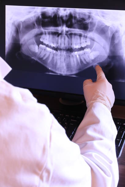Best Emergency Denture Repair in Essexville, MI