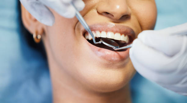 Best Emergency Root Canal Therapy in Essexville, MI