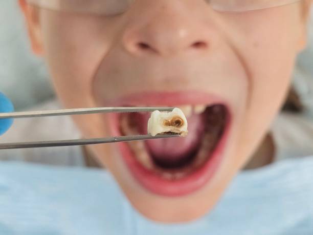 Best Emergency Treatment for Jaw Pain or Injury in Essexville, MI