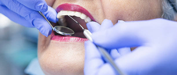 Best Broken or Chipped Tooth Repair in Essexville, MI
